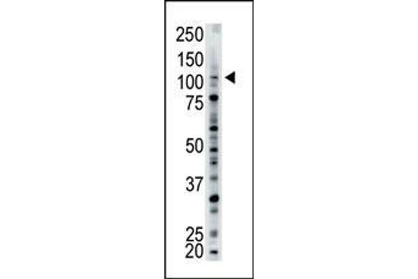 USP15 antibody  (N-Term)