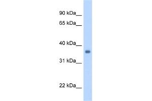 WB Suggested Anti-SGCG Antibody Titration:  1. (SGCG antibody  (Middle Region))