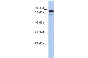 WB Suggested Anti-MTMR12 Antibody Titration: 0.