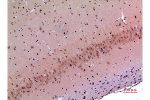 Immunohistochemistry (IHC) image for anti-Mesencephalic Astrocyte-Derived Neurotrophic Factor (MANF) (Internal Region) antibody (ABIN6287177)