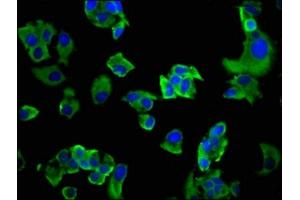 Immunofluorescence staining of MCF-7 cells with ABIN7163593 at 1:200, counter-stained with DAPI. (GP6 antibody  (AA 115-265))