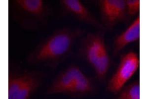 Immunofluorescence staining of methanol-fixed HeLa cells using MARCKS (Phospho-Ser162) Antibody (E011265, Red) (MARCKS antibody  (pSer162))