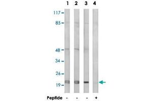 Western blot analysis of extracts from Jurkat cells (Lane 1), MCF-7 cells (Lane 2) and HepG2 cells (Lane 3 and lane 4), using MRPL32 polyclonal antibody . (MRPL32 antibody)
