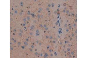 #VALUE! (DLG5 antibody  (AA 1724-1917))