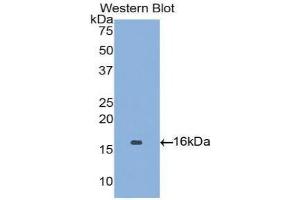 Western blot analysis of the recombinant protein. (Angiopoietin 2 antibody  (AA 1-123))