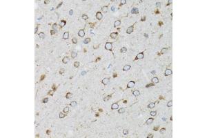Immunohistochemistry of paraffin-embedded rat brain using UBE2D1 antibody (ABIN3015751, ABIN3015752, ABIN3015753 and ABIN6219101) at dilution of 1:100 (40x lens).