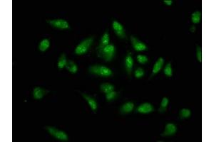 Immunofluorescence staining of Hela cells with ABIN7155794 at 1:133, counter-stained with DAPI. (MKX antibody  (AA 157-305))