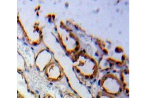 #VALUE! (Adiponectin Receptor 1 antibody  (AA 1-136))