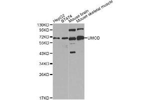 Western blot analysis of extracts of various cell lines, using UMOD Antibody. (Uromodulin antibody)