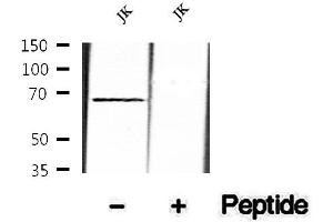 Western blot analysis of extracts of JK cells, using Phospho-SHP-1 (Tyr564) Antibody .