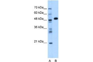 GPT antibody used at 1.