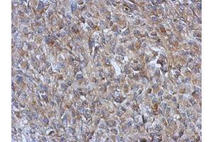 Immunohistochemistry (IHC) image for anti-Glutamic-Oxaloacetic Transaminase 2, Mitochondrial (Aspartate Aminotransferase 2) (GOT2) (Center) antibody (ABIN2855229)