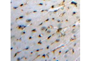 Used in DAB staining on fromalin fixed paraffin-embedded Heart tissue (HBEGF antibody  (AA 21-160))