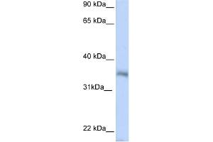 WB Suggested Anti-HEXIM2 Antibody Titration:  0.