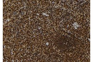 ABIN6263111 and ABIN6278722 at 1/100 staining Mouse spleen tissue by IHC-P.