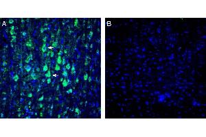 Immunohistochemistry (IHC) image for anti-Potassium Intermediate/small Conductance Calcium-Activated Channel, Subfamily N, Member 1 (KCNN1) (AA 75-93), (Intracellular) antibody (ABIN7043459)
