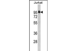Western blot analysis of HTATSF1 Antibody (N-term) (ABIN390597 and ABIN2840915) in Jurkat cell line lysates (35 μg/lane).