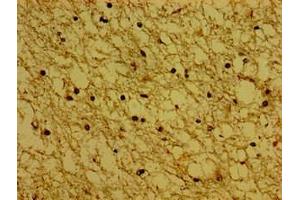 Immunohistochemistry of paraffin-embedded human brain tissue using ABIN7171138 at dilution of 1:100