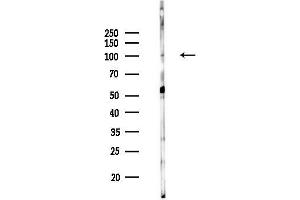 anti-Protein AF-10 (MLLT10) (Internal Region) antibody