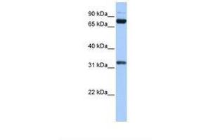 Image no. 1 for anti-TAF6 RNA Polymerase II, TATA Box Binding Protein (TBP)-Associated Factor, 80kDa (TAF6) (AA 576-625) antibody (ABIN6737845) (TAF6 antibody  (AA 576-625))