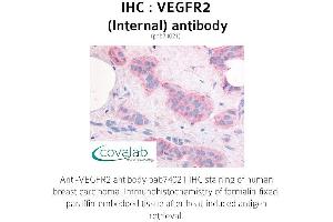 Image no. 1 for anti-VEGF Receptor 2 (VEGFR2) (Internal Region) antibody (ABIN1740694) (VEGFR2/CD309 antibody  (Internal Region))