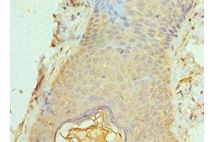 Immunohistochemistry of paraffin-embedded human skin tissue using ABIN7143053 at dilution of 1:100 (Actin-Like 6B antibody  (AA 1-280))