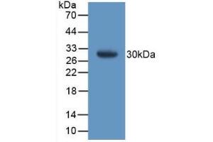 Detection of Recombinant GSTt1, Mouse using Polyclonal Antibody to Glutathione S Transferase Theta 1 (GSTt1) (GSTT1 antibody  (AA 7-240))