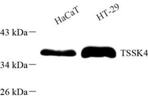 Western blot analysis of TSSK4 (ABIN7075865) at dilution of 1: 500