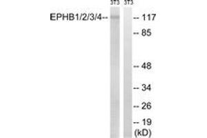 Western blot analysis of extracts from NIH-3T3 cells, treated with heat shock, using EPHB1/2/3/4 (Ab-600/602/614/596) Antibody. (EPH Receptor B1/2/3/4 (AA 566-615) antibody)