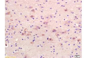 Formalin-fixed and paraffin embedded rat brain labeled with Anti-GRK6 Polyclonal Antibody, Unconjugated (ABIN1387719) at 1:200 followed by conjugation to the secondary antibody and DAB staining. (GRK4/GRK5/GRK6 (AA 181-280) antibody)