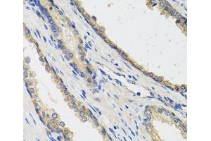 Immunohistochemistry of paraffin-embedded Human prostate using RAD51C Polyclonal Antibody at dilution of 1:100 (40x lens). (RAD51C antibody)