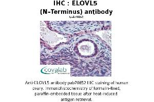 Image no. 2 for anti-ELOVL Fatty Acid Elongase 5 (ELOVL5) (N-Term) antibody (ABIN1733973)