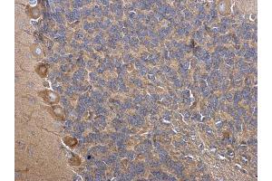 Immunohistochemistry (IHC) image for anti-phosphoribosyl Pyrophosphate Synthetase 1 (PRPS1) (N-Term) antibody (ABIN2855446)