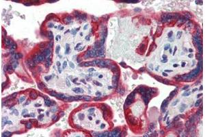 Human Placenta (formalin-fixed, paraffin-embedded) stained with SP3 antibody ABIN462188 followed by biotinylated goat anti-rabbit IgG secondary antibody ABIN481713, alkaline phosphatase-streptavidin and chromogen. (Sp3 antibody  (AA 287-336))