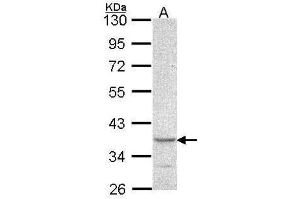 CYTIP antibody  (N-Term)