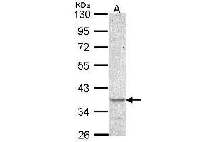 WB Image Sample (30 ug of whole cell lysate) A: A549 10% SDS PAGE antibody diluted at 1:1000 (CYTIP antibody  (N-Term))
