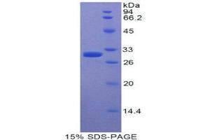 SDS-PAGE (SDS) image for Myosin IE (MYO1E) (AA 781-1036) protein (His tag) (ABIN2121690) (MYO1E Protein (AA 781-1036) (His tag))