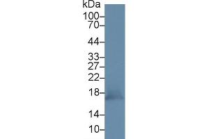 Detection of PRDX5 in Mouse Kidney lysate using Polyclonal Antibody to Peroxiredoxin 5 (PRDX5) (Peroxiredoxin 5 antibody  (AA 49-210))