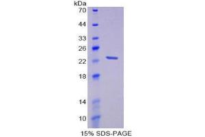 SDS-PAGE (SDS) image for Membrane Protein, Palmitoylated 6 (MAGUK P55 Subfamily Member 6) (MPP6) (AA 331-503) protein (His tag) (ABIN2125841)