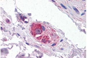 Human Small Intestine, Submucosal Plexus: Formalin-Fixed, Paraffin-Embedded (FFPE) (CYP26B1 antibody  (AA 418-430))