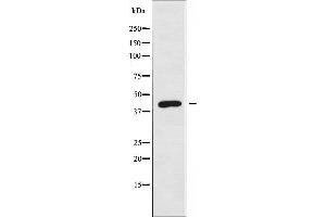 Western blot analysis of extracts from Jurkat cells using ARRDC3 antibody. (ARRDC3 antibody  (C-Term))