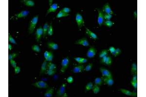 Immunofluorescence staining of Hela cells with ABIN7149290 at 1:66, counter-stained with DAPI. (CD131 antibody  (AA 492-710))