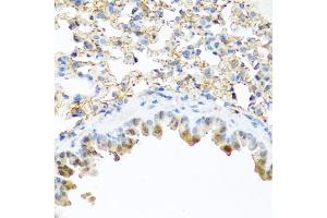 Immunohistochemistry of paraffin-embedded mouse lung using PI3 antibody (ABIN6132804, ABIN6145588, ABIN6145590 and ABIN6221092) at dilution of 1:100 (40x lens). (PI3 antibody  (AA 23-117))