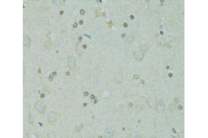 Immunohistochemistry of paraffin-embedded Rat brain using GTF2H2C Polyclonal Antibody at dilution of 1:100 (40x lens). (GTF2H2C antibody)