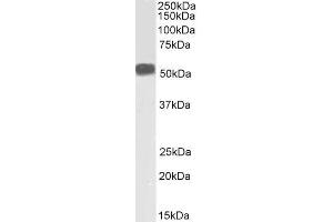 ABIN334386 (1µg/ml) staining of Human Skeletal Muscle lysate (35µg protein in RIPA buffer). (Desmin antibody  (C-Term))