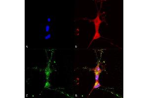 Immunocytochemistry/Immunofluorescence analysis using Mouse Anti-TrpC7 Monoclonal Antibody, Clone N64A/36 (ABIN2485422). (TRPC7 antibody  (AA 845-862) (Atto 594))