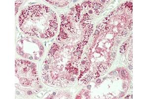 Formalin-fixed and paraffin-embedded H. (Plakophilin 4 antibody  (C-Term))