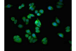 Immunofluorescent analysis of HepG2 cells using ABIN7167968 at dilution of 1:100 and Alexa Fluor 488-congugated AffiniPure Goat Anti-Rabbit IgG(H+L) (ARHGEF12 antibody  (AA 1302-1501))