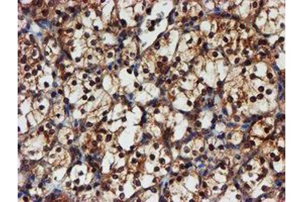 PSMA6 antibody