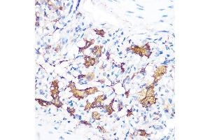 Immunohistochemistry of paraffin-embedded rat lung using FGF21 Rabbit mAb (ABIN1680154, ABIN3018263, ABIN3018264 and ABIN7101589) at dilution of 1:100 (40x lens). (FGF21 antibody)